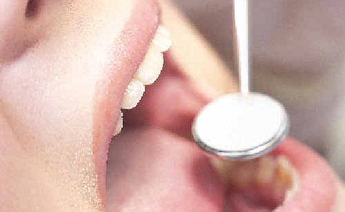 The Ultimate Dentist Guide